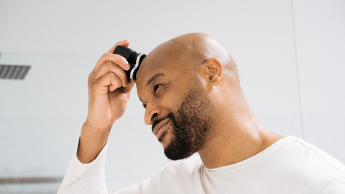 Red Light Therapy untuk kebotakan